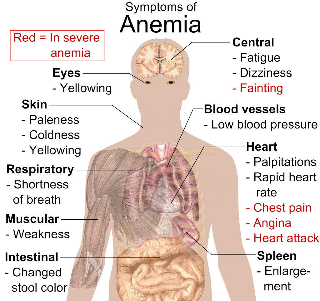 Symptoms_of_anemia